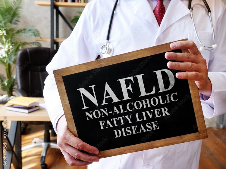 Non-Alcoholic Fatty Liver Disease (NAFLD) – Symptoms, Causes, Risk