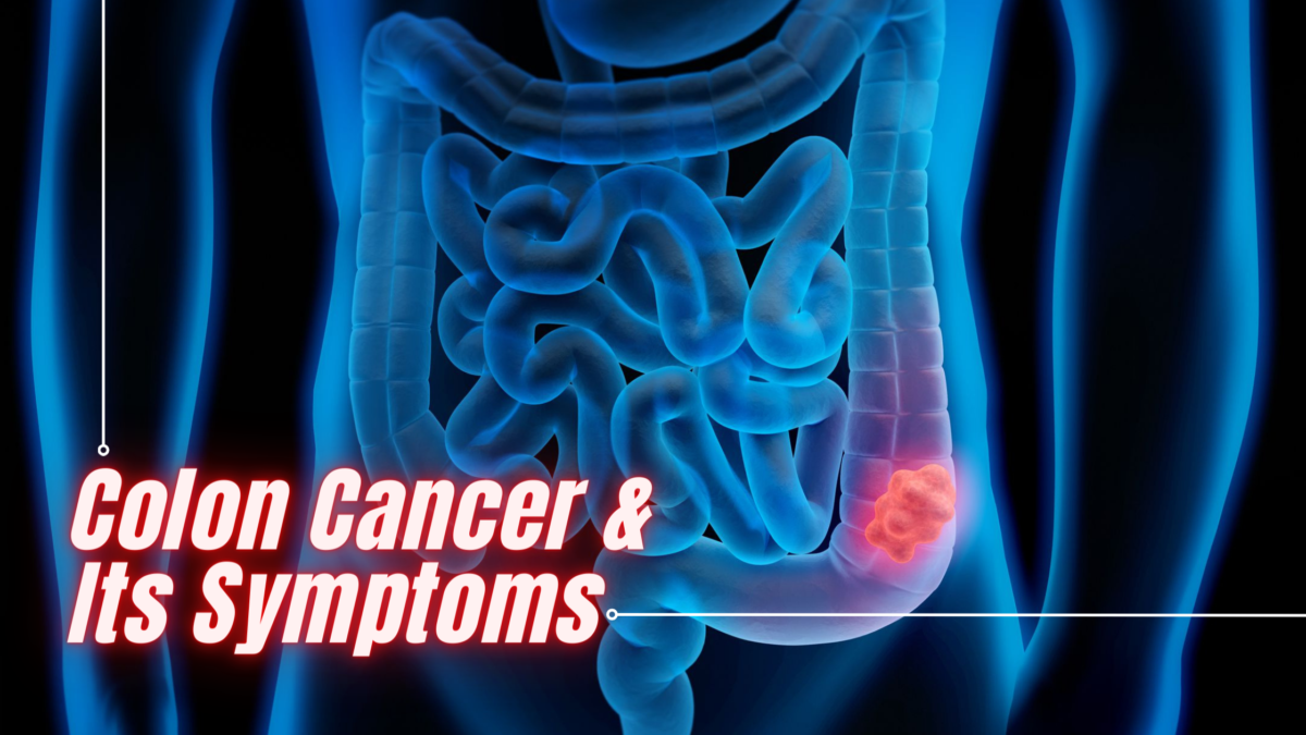 Colon Cancer and Its Symptoms