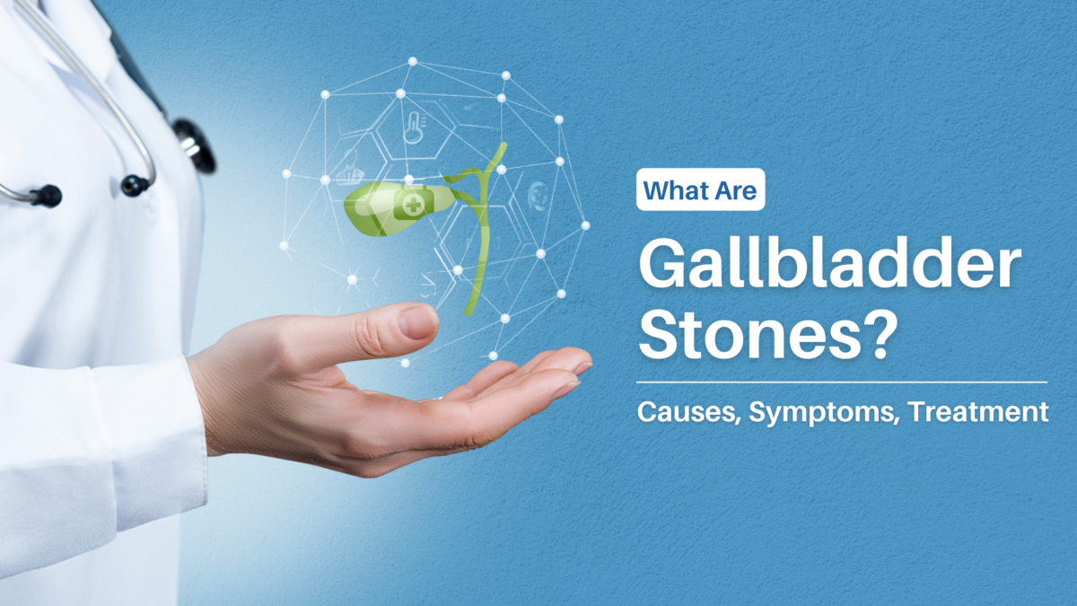 What Are Gallbladder Stones? Causes, Symptoms, Treatment
