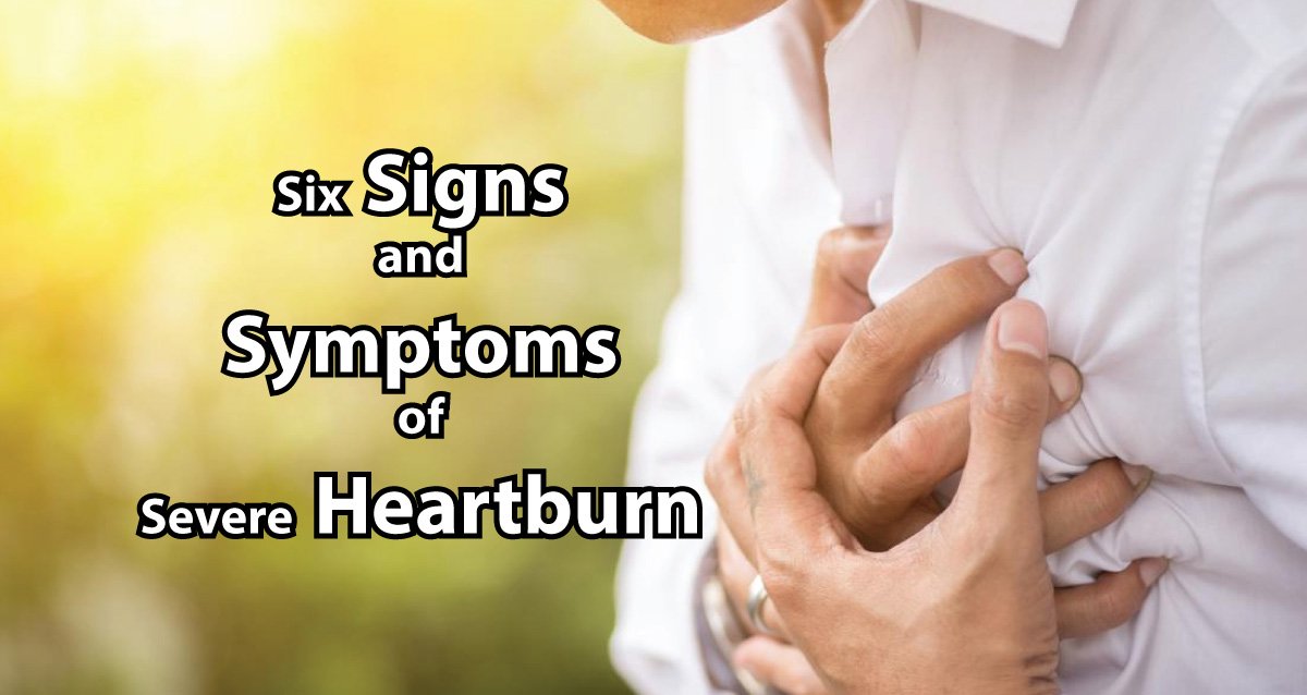 Six Signs and Symptoms of Severe Heartburn