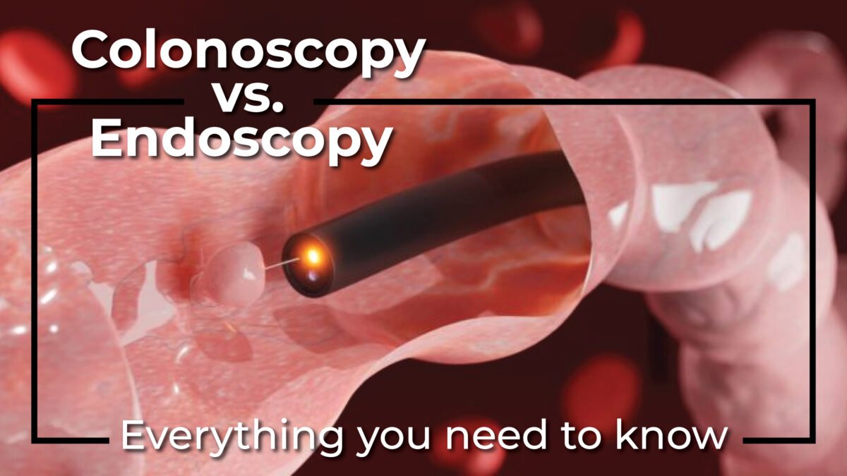 Colonoscopy vs. Endoscopy: Everything you need to know