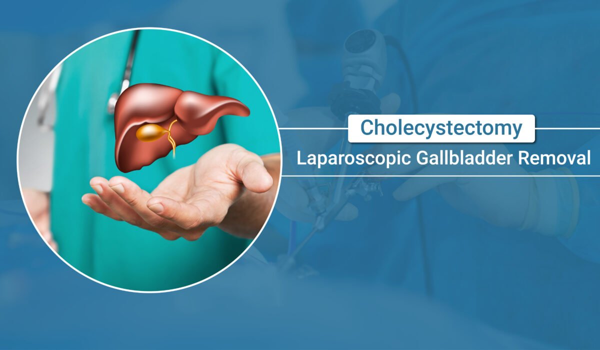 Laparoscopic Gallbladder Removal(Cholecystectomy): Understanding the Procedure