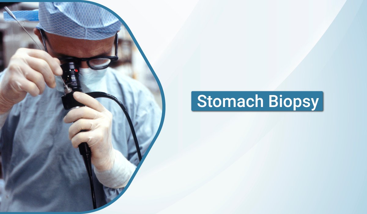 Stomach Biopsy