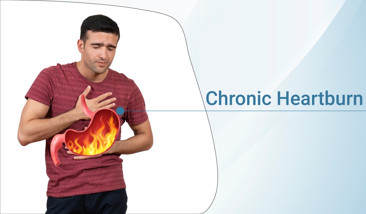 Everything that you should know about chronic heartburn