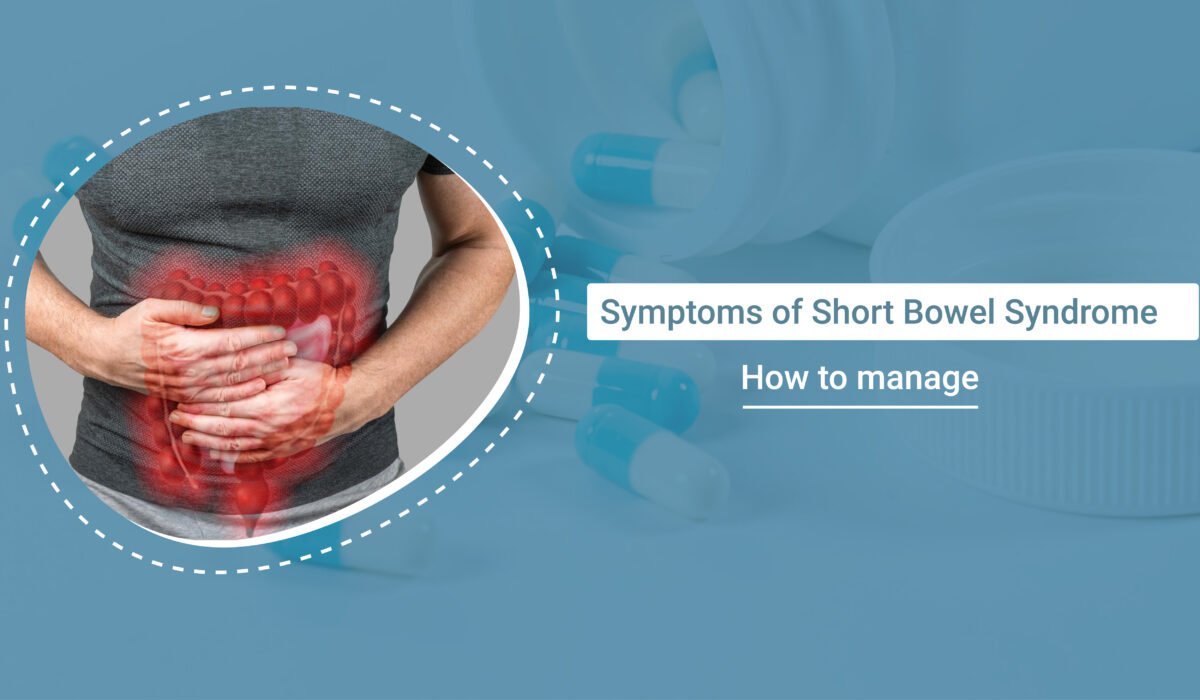 What are the Symptoms of Short Bowel syndrome and How to Manage Them?