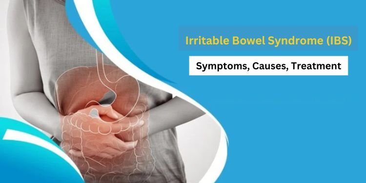 Irritable Bowel Syndrome (IBS) – Symptoms, Causes, Treatment