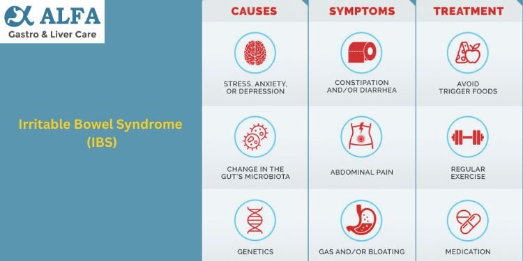 Irritable-Bowel-Syndrome(IBS)-Symptoms, Causes, Treatment