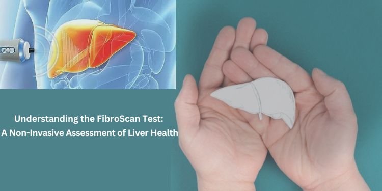 Understanding the FibroScan Test: A Non-Invasive Assessment of Liver Health