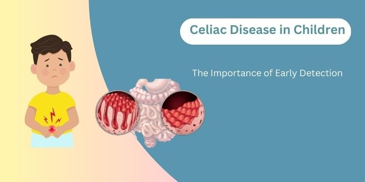 celiac-disease-in-children