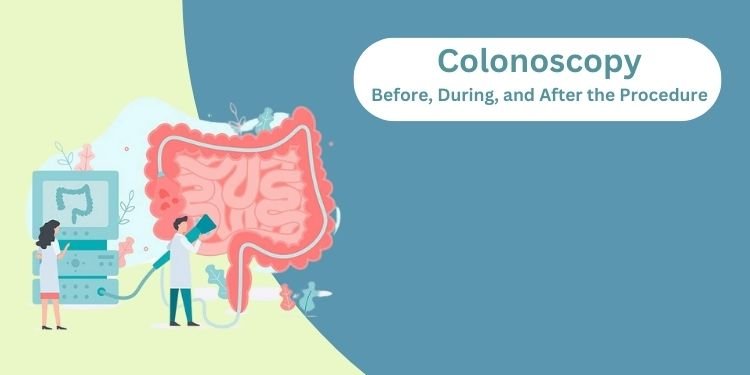 colonoscopy - before, during, and after procedure