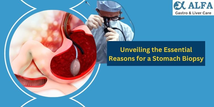 Exploring the Significance of Stomach Biopsies: Unveiling Diagnostic Insights and Purposes