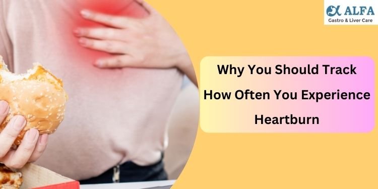 Why You Should Track How Often You Experience Heartburn