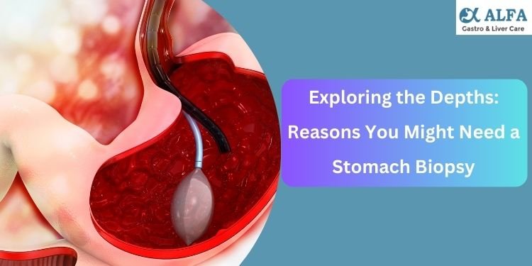 Exploring the Depths: Reasons You Might Need a Stomach Biopsy