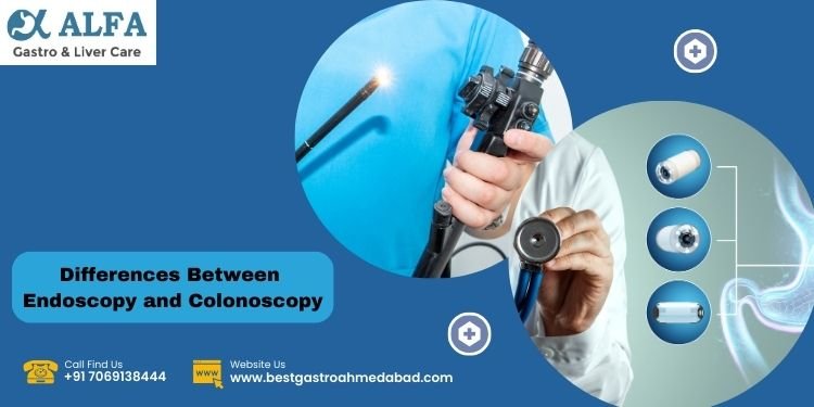 Differences Between Endoscopy and Colonoscopy Exams