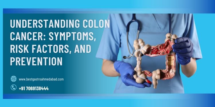 Understanding Colon Cancer: Symptoms, Risk Factors, and Prevention