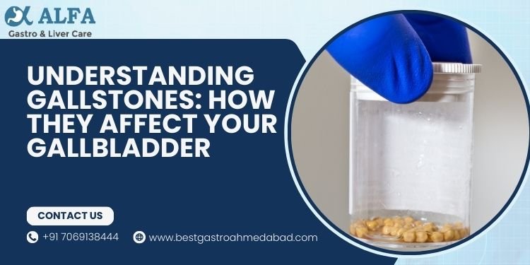 Understanding Gallstones How They Affect Your Gallbladder