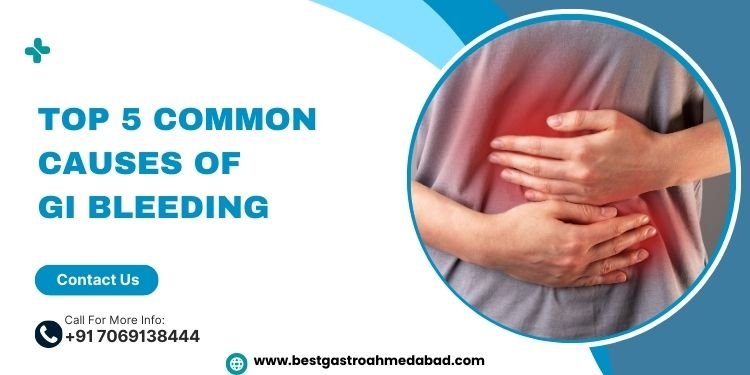 Top 5 Common Causes of GI Bleeding | Dr. Vatsal Mehta – Gastroenterologist