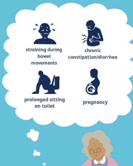 What Causes Hemorrhoids?