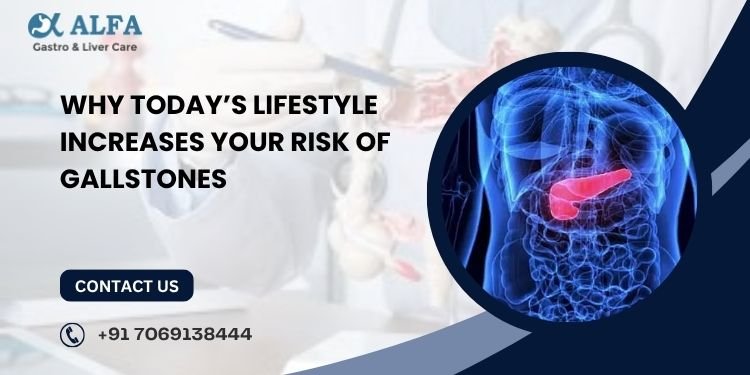 Why Today’s Lifestyle Increases Your Risk of Gallstones