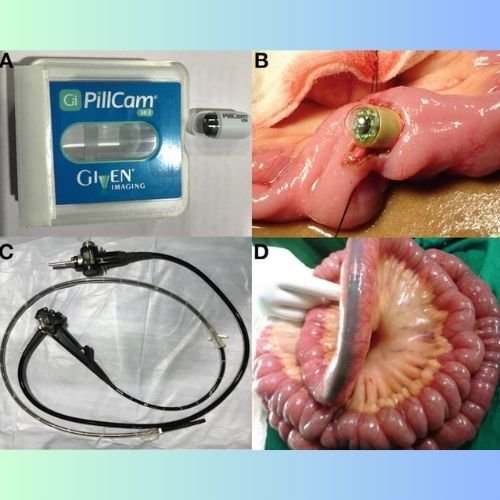 Small Bowel Enteroscopy
