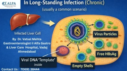 Dr.-Vatsal-Mehta-Gastroenterologist-iI-Alfa-Gastro-Liver-Care-Hospital-Vadaj-Ahmedabad