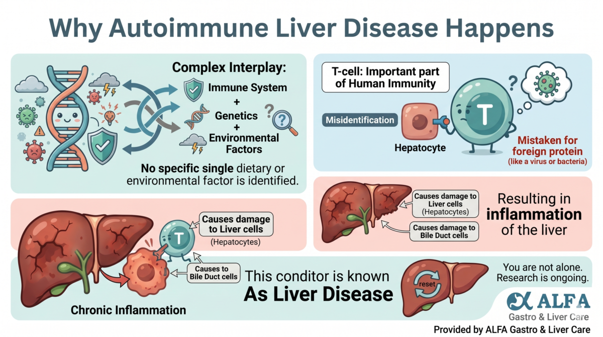 Autoimmune Liver Disease: Understanding the “Why” Behind the Disease