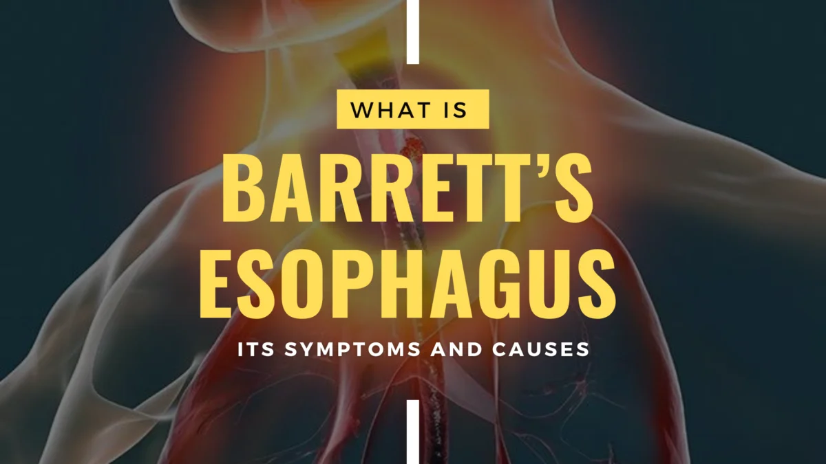 What is Barrett’s Esophagus? Its Symptoms and Causes