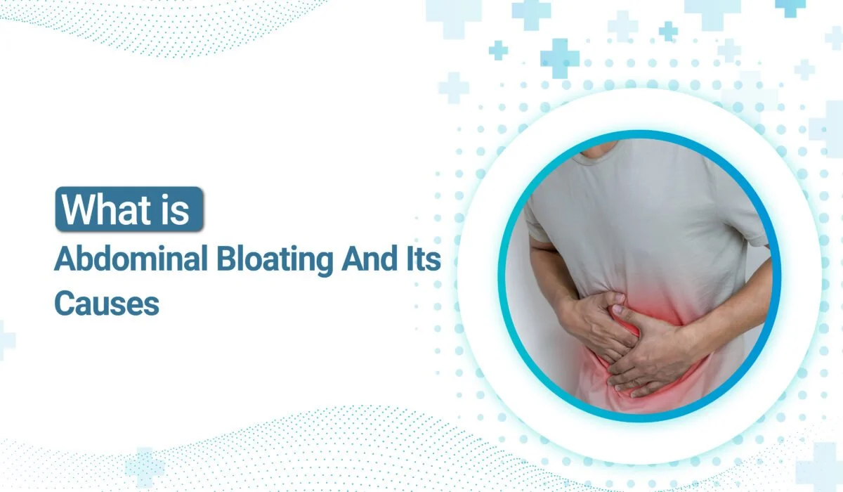 What is Abdominal Bloating, And Its Causes?
