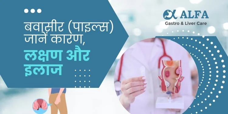 बवासीर (पाइल्स): लक्षण, निदान और उपचार